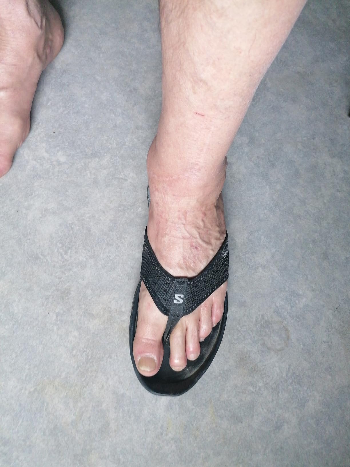 Mes pieds revivent après chaque sortie